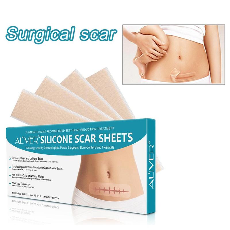 Silicone Surgical Scar Removal Patch Remove Trauma Burn Sheet Skin Repair Scar Removal Therapy Patch For Acne Scar Treatment